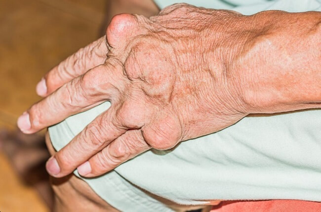 Người bệnh gout nên hạn chế ăn rau muống