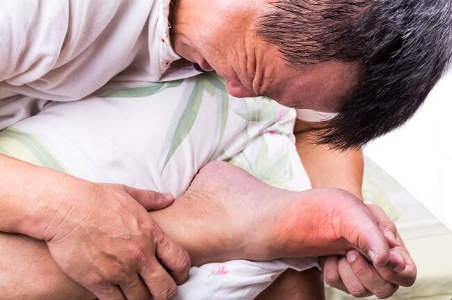 Bệnh gout có ăn được quả nhãn không?