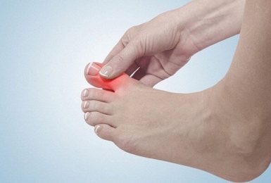 Đau ngón chân cái - Bệnh lý nguy hiểm không được chủ quan!