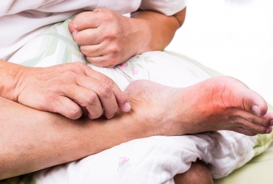 Lý giải nguyên nhân bệnh gout thường xảy ra vào ban đêm