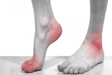 Viêm khớp – Dấu hiệu điển hình bệnh gout