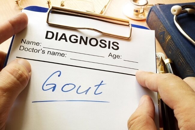 Tiêu chuẩn chẩn đoán bệnh gout